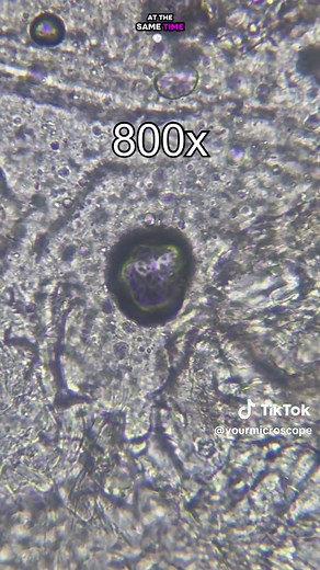 Exploring Sausages Under a Microscope