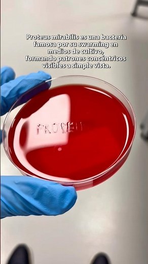 Proteus mirabilis | Ver video 🎥👆🏾| #shortvideo #parati #ciencia #microbiología #bacteria
