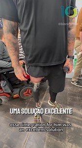 Andy | 🦿 Você sabia que a osseointegração exige uma avaliação cuidadosa de um especialista em próteses e um médico? Conheça a história de Andy, que usou uma prótese convencional por quatro anos e não se adaptou. Hoje, com a osseointegração, ele vive uma vida plena e sem limitações. Na Bionicenter, estamos comprometidos em oferecer o melhor atendimento e tecnologia aos nossos pacientes. Se você tem interesse em osseointegração, entre em contato conosco pelo WhatsApp (12) 99754-5582 e saiba mais 