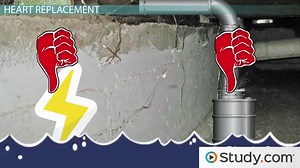 Heart Transplant: Patients Who Need Them, Risks & Statistics