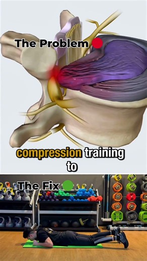 ⚡️ Stop Squatting With A Disc Bulge (Do This) 🛑