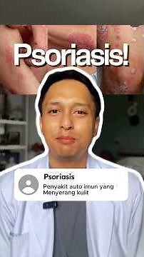 Psoriasis Penyakit Berbahaya? #edukasikesehatan #infokesehatan #psoriasis