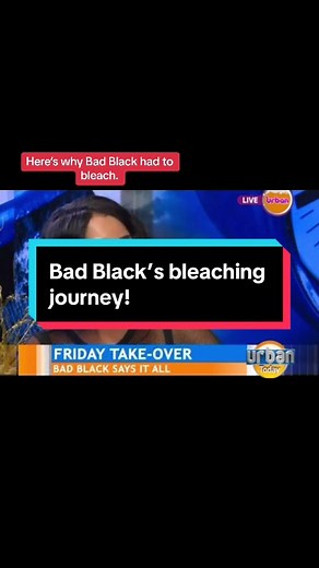 Bad Black's Skin Bleaching Journey