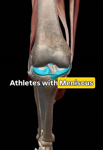 Post Meniscus Repair Surgery Care Tips