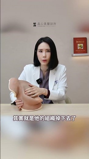 產後你是上胸沒肉還是胸部下垂？很多人其實分不清！晶心美醫診所、整形外科醫師鄭穎