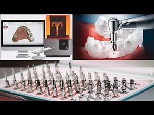 OSSTEM ANTA ON 4 guided surgery with OneGuide surgical kit