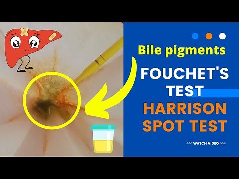 Fouchet's test - Harrison Spot Test (for detection of bile pigments in Urine)