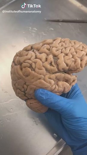 The right hemisphere of a REAL human brain. @instituteofhumananatomy