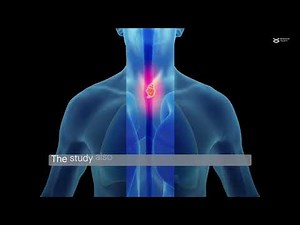 NACK and INT coordinately activate Notch-mediated transcription in tumorigenesis