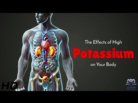 Hyperkalemia Explained: The Dangers of High Potassium Levels