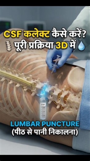 CSF collect kaise kiya jaata hai |csf collection full procedure 3D#anatomy #shorts