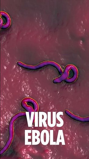 What Are Ebola Symptoms and How to Prevent Them?