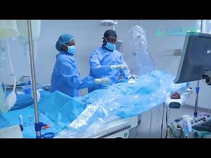 Dr B. D. Sarkodie is talking about Brain Aneurysm Coiling procedure.