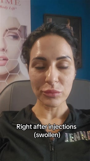 The best injectors in Arizona? Revital-AZ in Cave Creek, hands down!...