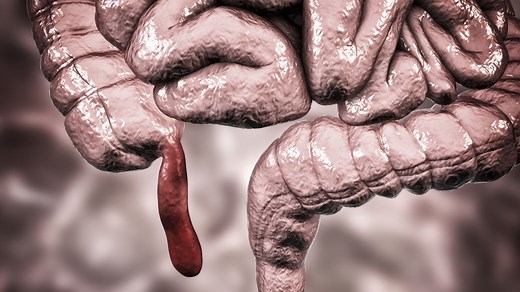 What if humans didn't have an appendix?