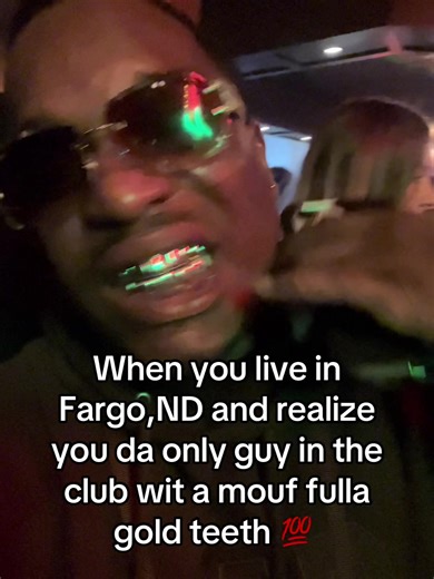Living in Fargo: Unique Experiences with Gold Teeth