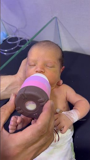 NICU Baby Care After Feeding Time 🍼 | Exchange Transfusion Support #cute #baby #newborn #babycare