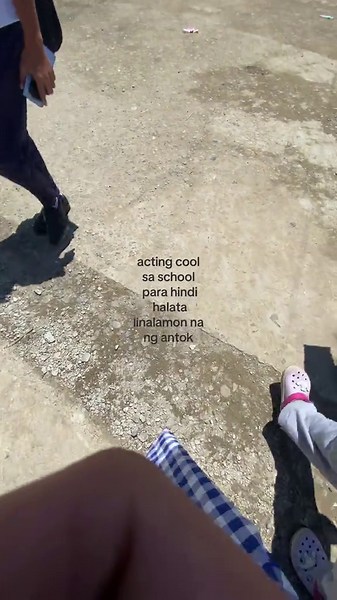 #post #fyp #viral #onsts #foryou | Acting Tips And Tricks