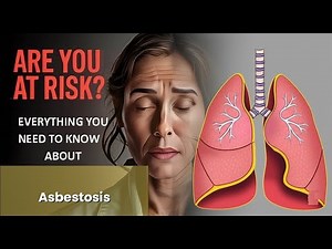 Asbestosis Explained Causes, Symptoms and Treatment, All Insights