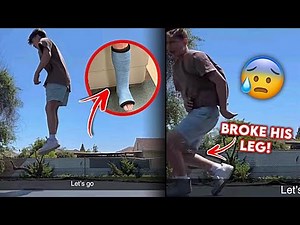 Nidal Wonder Broke His Leg again After Jumping on TRAMPOLINE?!