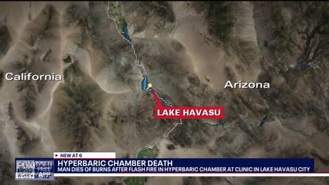 AZ man dies following hyperbaric chamber fire