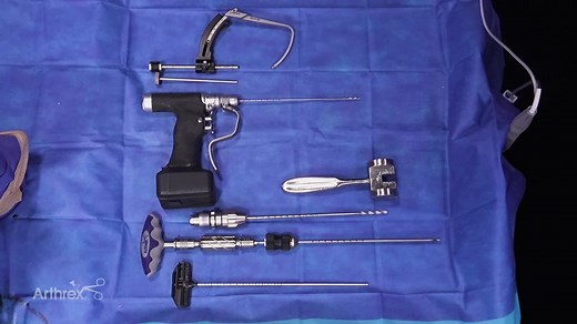 Core Decompression for Osteochondritis Dissecans