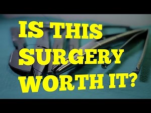 The TRUTH about Subacromial Decompression Surgery