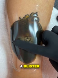 34K views · 128 reactions | If your fresh tattoo forms a blister-like bubble, don’t worry—it’s often part of the healing process! #TattooHealing #TattooCare #Saniderm #InkLife #TattooAftercare #HealingProcess #TattooTips | Facts Wiki | Facebook