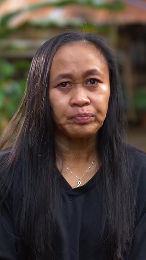 I'm only 16 - but my mystery condition makes me look years older ❤️‍🩹 #fbreels #borndifferent #agingcondition #rarecondition | Born Different