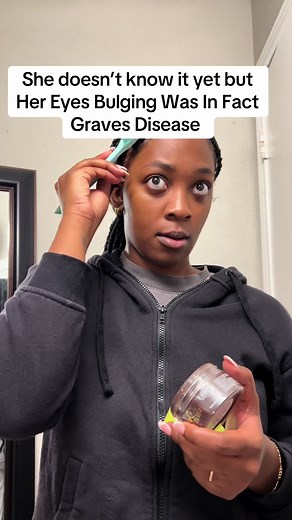 Amyra✨🖤 (@i.am.amyra)’s video of graves disease
