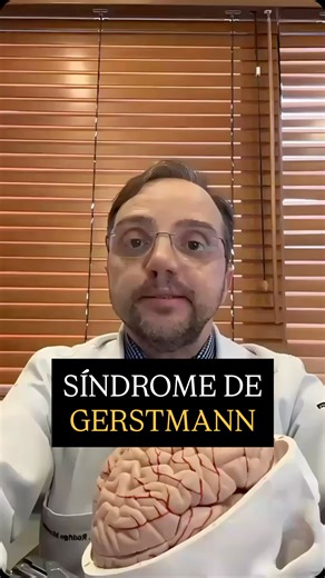 A Síndrome de Gerstmann é um distúrbio neurológico causado por uma lesão no giro angular, região do lobo parietal esquerdo responsável por integrar funções como escrita, cálculo e orientação espacial. Quando essa área é afetada, o paciente pode apresentar um conjunto clássico de quatro sintomas que costumam surgir de forma repentina e confusa: dificuldade para escrever, dificuldade para realizar cálculos simples, incapacidade de reconhecer os próprios dedos e confusão entre direita e esquerda. I