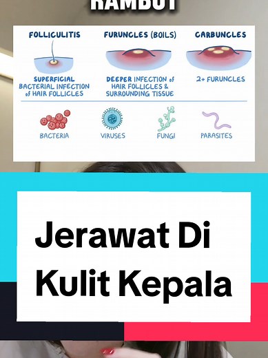 Tips Mengatasi Jerawat Di Kepala Secara Efektif