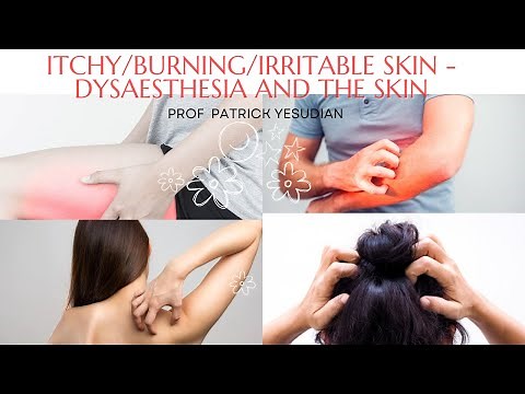 Irritable/Itchy/Burning skin - Dysaesthesia and the skin