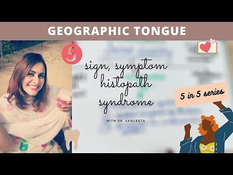 geographic tongue
