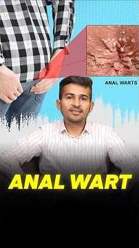 Anal wart | Dr. Padam Kumar