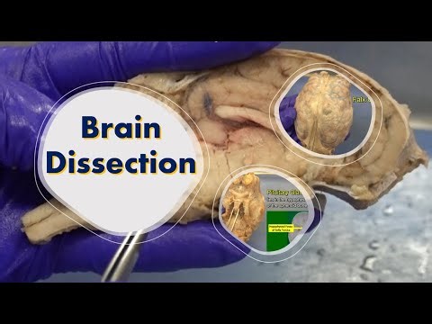Brain Dissection