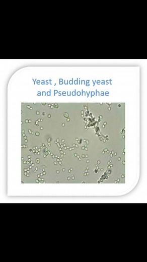 54 reactions · 4 comments |  RBC and Yeast cell in Urine Examination...