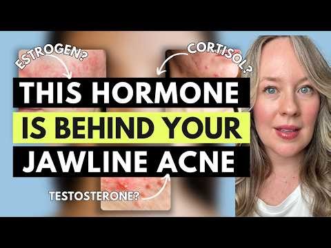 Hormonal Imbalances that cause acne - 6 MAIN HORMONAL ACNE TRIGGERS