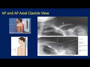 Radiographs of the Shoulder for the Primary Care Physician