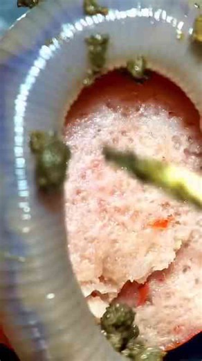 Hot dog under the microscope!