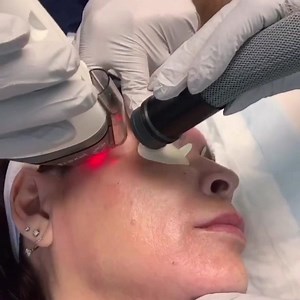 52 reactions · 3 comments | Fraxel laser procedures are great for treating sun damage, brown spots, acne scars, and fine lines by stimulating new collagen and giving the face a more youthful appearance. Lunch and learn with Dr. Mohsin Mir on Feb. 21 to hear more about nonsurgical facial rejuvenation. Space is limited, RSVP today: bit.ly/Mir22020 | Kelsey-Seybold Clinic | Facebook