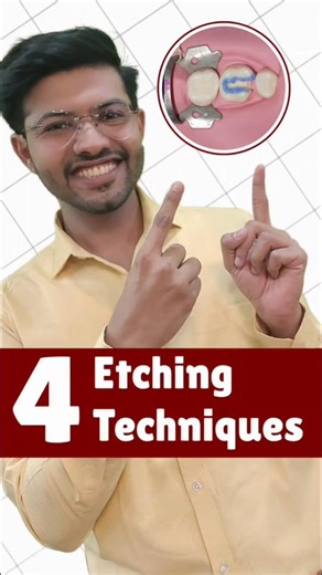 Dr Akash Shah on Instagram: "Etching Techniques in Dentistry: A Comprehensive Guide Total Etch Technique The Total Etch technique involves etching the entire cavity with 37% phosphoric acid for 30 seconds, typically used for enamel-only cavities. Selective Etch Technique The Selective Etch technique involves etching enamel for 25 seconds and dentin for 5 seconds, ideal for cavities involving both enamel and dentin. Partial Etch Technique The Partial Etch technique involves etching enamel for 30 