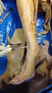 Femoral nerve and dorsum of the foot Dissection of cadaver ( human anatomy lab) The science fiction method is dissection and reconstruction GMC JAMMU - SGR - DODA - BARAMULLA - RAJOURI - KATHUA - ANANTNAG GMC DODA Medical Daily Obair Gul Bhat Mohsin Portea Medical Department of Health, Medical & Family Welfare,Government of Andhra Pradesh Sumit Deb Nath Sha Hid Beli Ever Government Medical College Doda education.com Irfan Gulzar Health Savage Paramedics Times Knowledge Cadaver REAL Education MLT