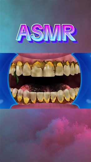 Mouth and Teeth Cleaning ASMR Experience