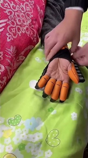 ▶️ Hand recovery after stroke ( # 1092 ) Effortless Exercise Automatic Hand Trainer Gloves
