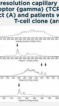 T cell Receptor Sequencing - Advanced Diagnosis for Lymphoma