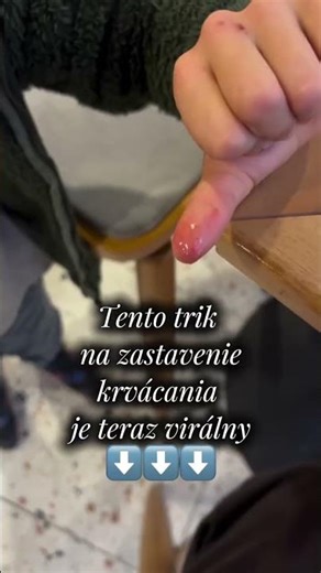 Zastav krvácanie #shorts