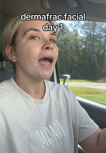 DermaFrac Facial Treatment Progress: Day 1