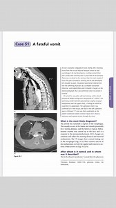 General Surgical cases 6 | Surgery | Facebook