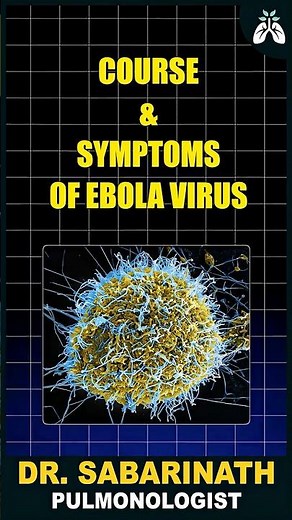 Ebola Virus அறிகுறிகள் | Dr Sabarinath Ravichandar Explains